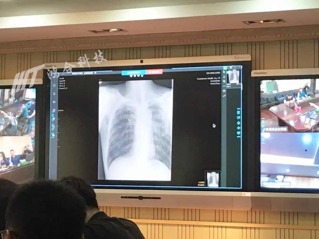 結(jié)核病醫(yī)院經(jīng)常利用鴻合會議平板進(jìn)行重要的專家會診